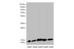 Western blot<br />
All lanes:DNAJC19 antibody at 0.9 ug/ml<br />
Lane 1 : Mouse lung tissue<br />
Lane 2 : Mouse kidney tissue<br />
Lane 3 : A549 whole cell lysate<br />
Lane 4 : HL60 whole cell lysate<br />
Lane 5 : Hela whole cell lysate<br />
Secondar