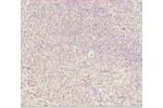 Immunohistochemistry of paraffin-embedded human tonsil tissue using CSB-PA853416ESR1HU at dilution 1:100