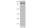 Western blot<br />
All lanes: DDX11 antibody at 8.47 ug/ml<br />
Lane 1 : Mouse gonadal tissue<br />
Lane 2 : K562 whole cell lysate<br />
Secondary<br />
Goat polyclonal to rabbit IgG at 1/10000 dilution<br />
Predicted band size: 109,102,99,97,33 kDa<br