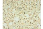 Immunohistochemistry of paraffin-embedded human adrenal gland tissue using CSB-PA853423LA01HU at dilution of 1:100