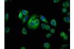 Immunofluorescence staining of A549 cells with CSB-PA853482LA01HU at 1:66,counter-stained with DAPI. The cells were fixed in 4% formaldehyde, permeabilized using 0.2% Triton X-100 and blocked in 10% normal Goat Serum. The cells were then incubated with th
