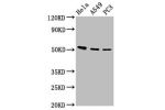 Western Blot<br />
Positive WB detected in:Hela whole cell lysate,A549 whole cell lysate,PC3 whole cell lysate<br />
All lanes:ALS2CR12 antibody at 12