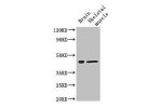 Western Blot<br />
Positive WB detected in:Mouse brain tissue,Mouse skeletal muscle tissue<br />
All lanes: FAM43A antibody at 3ug/ml<br />
Secondary<br />
Goat polyclonal to rabbit IgG at 1/50000 dilution<br />
Predicted band size: 46 kDa<br />
Observed 