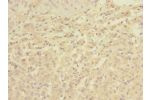 Immunohistochemistry of paraffin-embedded human adrenal gland tissue CSB-PA854077LA01HU at dilution 1:100