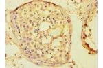 Immunohistochemistry of paraffin-embedded human testis using CSB-PA854082ESR2HU at dilution 1:100