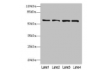 Western blot<br />
All lanes: FLAD1 antibody at 4ug/ml<br />
Lane 1 : HepG-2 whole cell lysate<br />
Lane 2 : LO2 whole cell lysate<br />
Lane 3 : MDA-MB-231 whole cell lysate<br />
Lane 4 : Hela whole cell lysate<br />
Secondary<br />
Goat polyclonal to 