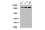 Western Blot<br />
Positive WB detected in:Hela whole cell lysate,Mouse liver tissue,Mouse lung tissue<br />
All lanes:CPT1C antibody at 2.6