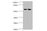 Western blot<br />
All lanes:DCAF4 antibody at 2ug/ml<br />
Lane 1:293T whole cell lysate<br />
Lane 2:Hela whole cell lysate<br />
Secondary<br />
Goat polyclonal to rabbit at 1/10000 dilution<br />
Predicted band size: 56,49,45,55 kDa<br />
Observed ban