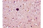 IHC image of CSB-PA855500LA01HU diluted at 1:100 and staining in paraffin-embedded human brain tissue performed on a Leica BondTM system. After dewaxing and hydration, antigen retrieval was mediated by high pressure in a citrate buffer (pH 6.0). Section w