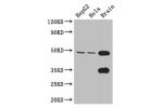 Western Blot<br />
Positive WB detected in:HepG2 whole cell lysate,Hela whole cell lysate,Mouse brain tissue<br />
All lanes: DYX1C1 antibody at 3.4ug/ml<br />
Secondary<br />
Goat polyclonal to rabbit IgG at 1/50000 dilution<br />
Predicted band size: 49