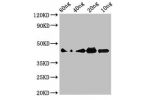Western Blot<br />
Positive WB detected in Recombinant protein<br />
All lanes:C3 antibody at 3