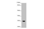 Western blot<br />
All lanes: FAM3C antibody at 4ug/ml+A431 whole cell lysate<br />
Goat polyclonal to rabbit at 1/10000 dilution<br />
Predicted band size: 25 kDa<br />
Observed band size: 25 kDa<br />