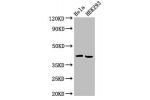 Western Blot<br />
Positive WB detected in:Hela whole cell lysate,HEK293 whole cell lysate<br />
All lanes:ARPC1A antibody at 4
