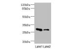 Western blot<br />
All lanes: EAF2 antibody at 3.6ug/ml<br />
Lane 1 : Rat heart tissue<br />
Lane 2 : Mouse kidney tissue<br />
Secondary<br />
Goat polyclonal to rabbit IgG at 1/10000 dilution<br />
Predicted band size: 29,15 kDa<br />
Observed band siz