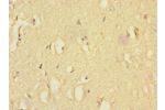 Immunohistochemistry of paraffin-embedded human brain tissue CSB-PA856910DSR2HU at dilution 1:100
