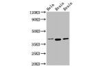 Western Blot<br />
Positive WB detected in:Hela whole cell lysate,Rat brain tissue,Mouse brain tissue<br />
All lanes:ERGIC2 antibody at 2.5