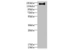 Western blot<br />
All lanes: VSX1 antibody IgG at 0.87ug/ml+ Hela whole cell lysate<br />
Secondary<br />
Goat polyclonal to rabbit IgG at 1/10000 dilution<br />
Predicted band size: 159,154,153,152,151,147,160 kDa<br />
Observed band size: 158 kDa<br />