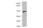 Western blot<br />
All lanes:CYTH2 antibody at 5.1ug/ml+MCF-7 whole cell lysate<br />
Secondary<br />
Goat polyclonal to rabbit at 1/10000 dilution<br />
Predicted band size: 47kDa<br />
Observed band size: 47kDa<br />