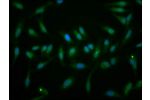 Immunofluorescence staining of Hela cells with CSB-PA857862LA01HU at 1:166,counter-stained with DAPI. The cells were fixed in 4% formaldehyde, permeabilized using 0.2% Triton X-100 and blocked in 10% normal Goat Serum. The cells were then incubated with t