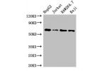 Western Blot<br />
Positive WB detected in:HepG2 whole cell lysate,Jurkat whole cell lysate,RAW264.7 whole cell lysate,Raji whole cell lysate<br />
All lanes:CDC6 antibody at 2.5