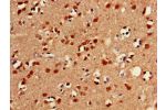 Immunohistochemistry of paraffin-embedded human brain tissue using CSB-PA857880LA01HU at dilution of 1:100