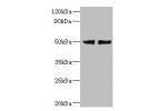 Western blot<br />
All lanes: FAM118B antibody at 12ug/ml<br />
Lane 1 : Jurkat whole cell lysate<br />
Lane 2 : U251 whole cell lysate<br />
Secondary<br />
Goat polyclonal to Rabbit IgG at 1/10000 dilution<br />
Predicted band size: 39 kDa<br />
Observe