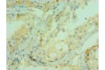 Immunohistochemistry of paraffin-embedded human testicle using CSB-PA858712ESR2HU at dilution 1:100