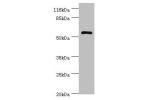 Western blot<br />
All lanes:DPH2 antibody at 2ug/ml+mouse brain tissue<br />
Secondary<br />
Goat polyclonal to rabbit at 1/10000 dilution<br />
Predicted band size: 53,28,39 kDa<br />
Observed band size: 52 kDa<br />