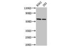 Western Blot<br />
Positive WB detected in:K562 whole cell lysate,293 whole cell lysate<br />
All lanes:CCT7 antibody at 3