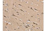 The image on the left is immunohistochemistry of paraffin-embedded Human brain tissue using CSB-PA859167(DLG2 Antibody) at dilution 1/40, on the right is treated with synthetic peptide. (Original magnification: 