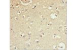 Immunohistochemistry of paraffin-embedded human brain tissue using CSB-PA859511ESR2HU at dilution 1:100