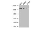 Western Blot<br />
Positive WB detected in:Hela whole cell lysate,HEK293 whole cell lysate,Jurkat whole cell lysate<br />
All lanes: ATXN2 antibody at 3ug/ml<br />
Secondary<br />
Goat polyclonal to rabbit IgG at 1/50000 dilution<br />
Predicted band size