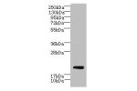 Western blot<br />
All lanes: C17orf62 antibody at 1.5ug/ml+Mouse liver tissue<br />
Goat polyclonal to rabbit at 1/10000 dilution<br />
Predicted band size: 21,20 kDa<br />
Observed band size: 21 kDa<br />