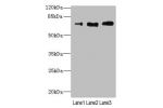 Western blot<br />
All lanes: CD180 antibody at 3.95ug/ml<br />
Lane 1 : A549 whole cell lysate<br />
Lane 2 : A431 whole cell lysate<br />
Lane 3 : HepG-2 whole cell lysate<br />
Secondary<br />
Goat polyclonal to rabbit IgG at 1/10000 dilution<br />
Pre
