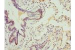 Immunohistochemistry of paraffin-embedded human lung tissue using CSB-PA859942ESR1HU at dilution 1:100