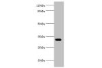 All lanes:1-acyl-sn-glycerol-3-phosphate acyltransferase alpha antibody at 6ug/ml+K562 whole cell lysate<br />
Secondary<br />
Goat polyclonal to rabbit at 1/10000 dilution<br />
Predicted band size: 32kDa<br />
Observed band size: 32kDa<br />