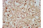 IHC image of CSB-PA860346LA01HU diluted at 1:300 and staining in paraffin-embedded human brain tissue performed on a Leica BondTM system.