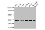 Western Blot<br />
Positive WB detected in:Hela whole cell lysate,Mouse liver tissue,Mouse lung tissue,Mouse kidney tissue,Mouse brain tissue,Mouse skeletal muscle tissue<br />
All lanes: CNN2 antibody at 2.5ug/ml<br />
Secondary<br />
Goat polyclonal to 