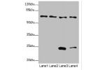 Western blot<br />
All lanes:EYA3 antibody at 1.49ug/ml<br />
Lane 1