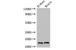 Western Blot<br />
Positive WB detected in:Rat kidney tissue,Mouse brain tissue<br />
All lanes:CHP1 antibody at 2.4