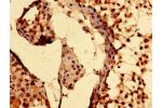 Immunohistochemistry of paraffin-embedded human testis tissue using CSB-PA860780LA01HU at dilution of 1:100