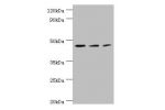 Western blot<br />
All lanes:ACY1 antibody at 4ug/ml<br />
Lane 1:K562 whole cell lysate<br />
Lane 2:HepG2 whole cell lysate<br />
Lane 3:Mouse kidney tissue<br />
Secondary<br />
Goat polyclonal to rabbit at 1/10000 dilution<br />
Predicted band size: 4