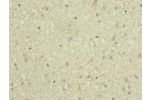 Immunohistochemistry of paraffin-embedded human brain tissue CSB-PA861078ESR1HU at dilution 1:100