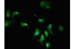 Immunofluorescent analysis of MCF-7 cells using CSB-PA861078LA01HU at a dilution of 1:100 and Alexa Fluor 488-congugated AffiniPure Goat Anti-Rabbit IgG(H+L)