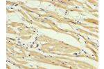 IHC image of CSB-PA861144LA01HU diluted at 1:400 and staining in paraffin-embedded human heart tissue performed on a Leica BondTM system. After dewaxing and hydration, antigen retrieval was mediated by high pressure in a citrate buffer (pH 6.0). Section w