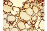 Immunohistochemistry of paraffin-embedded human thyroid tissue using CSB-PA861146LA01HU at dilution of 1:100