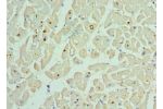 Immunohistochemistry of paraffin-embedded human heart using CSB-PA861162DSR1HU at dilution 1:100