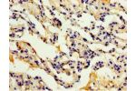 Immunohistochemistry of paraffin-embedded human lung tissue using CSB-PA861182ESR1HU at dilution 1:100