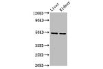 Western Blot<br />
Positive WB detected in:Rat liver tissue,Rat kidney tissue<br />
All lanes:DLST antibody at 5.9