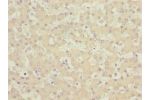 Immunohistochemistry of paraffin-embedded human liver tissue using CSB-PA861986DSR1HU at dilution 1:100